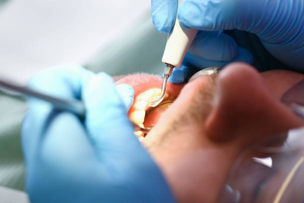 Best Holiday Emergency Dentist in Jerseyvle, IL