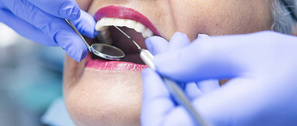 Best Emergency Dentist for Knocked-Out Tooth in Jerseyvle, IL